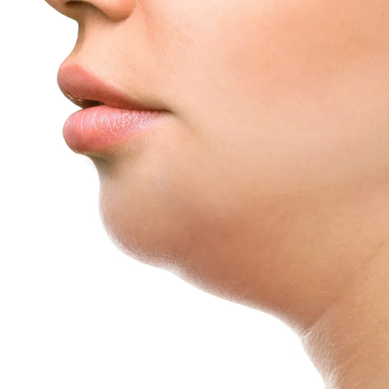 Image of mouth, jawline, and chin of the face